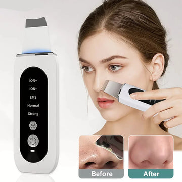 Ultrasonic Skin Scrubber Peeling Blackhead Remover